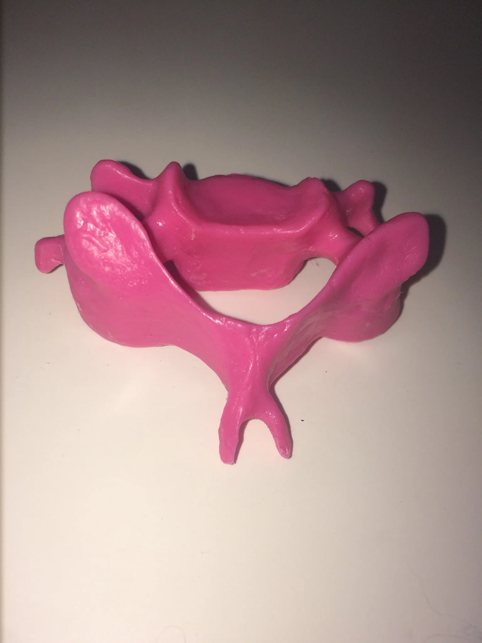 SB3 Representative Set of 3 Vertebrae strung on nylon