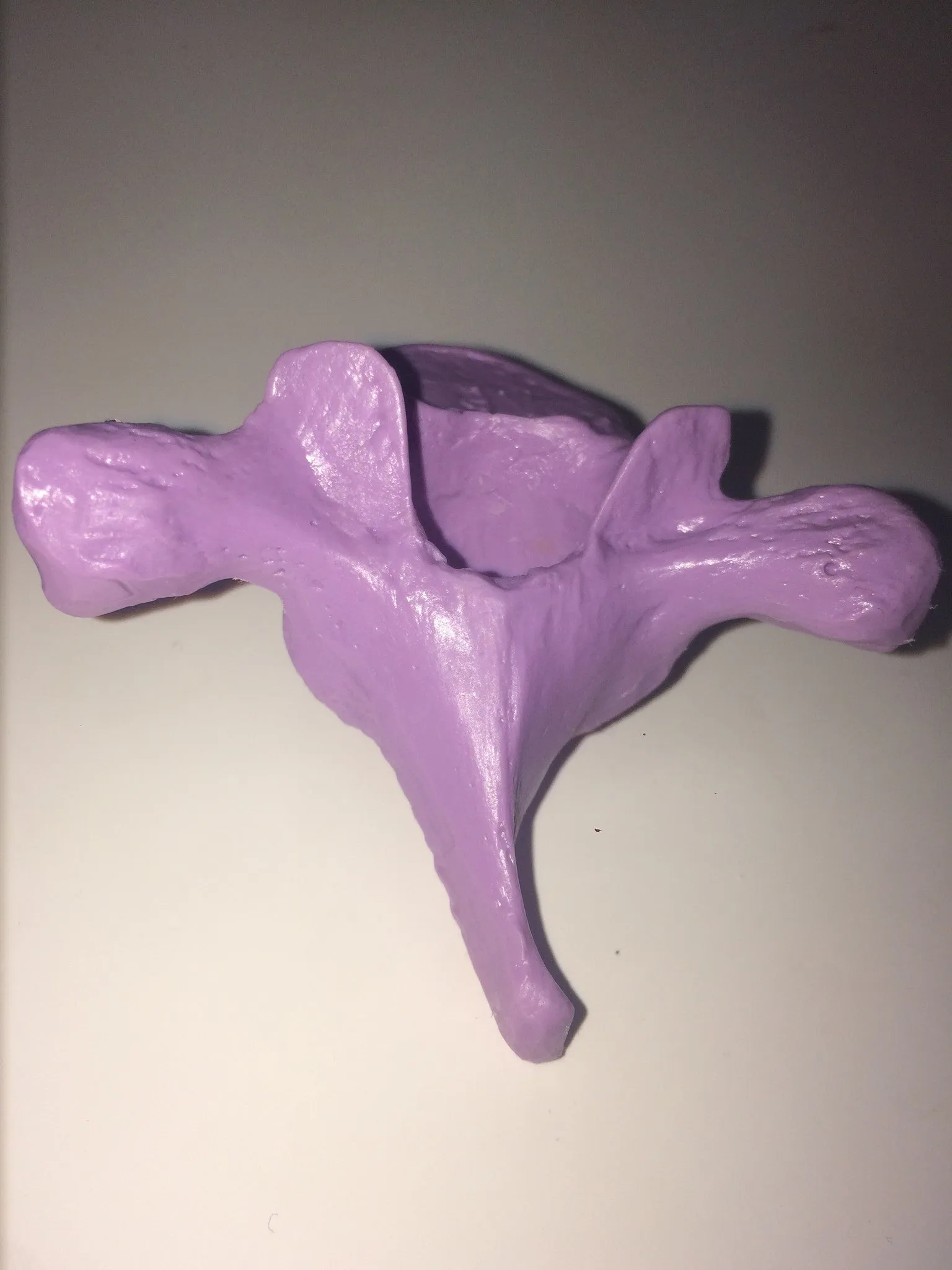 SB3 Representative Set of 3 Vertebrae strung on nylon